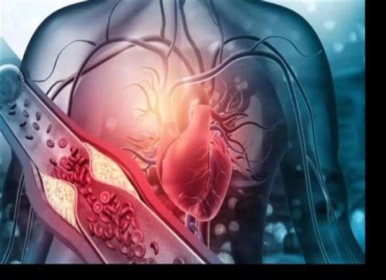 تُعزز صحة القلب.. فوائد الحبة السوداء للجسم 