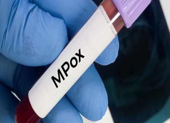 Un nouveau kit de diagnostic du Mpox prêt à être commercialisé au Maroc