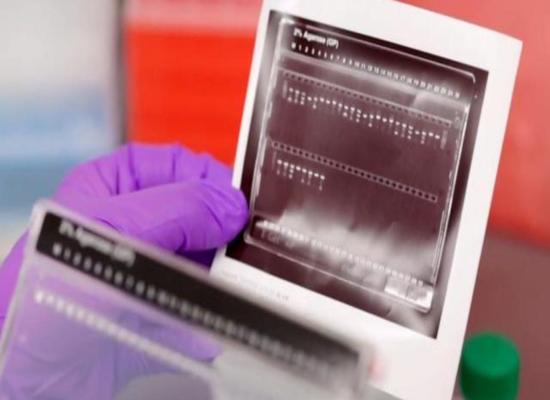 FDA approves first gene therapy for sickle cell disease