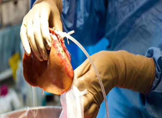 80% des médecins marocains souhaitent approfondir leur connaissance sur le don d’organe